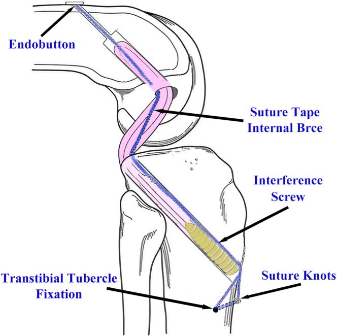 https://cdn.ncbi.nlm.nih.gov/pmc/blobs/7526/11662888/70705617dcbb/gr1.jpg