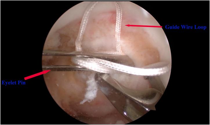 https://cdn.ncbi.nlm.nih.gov/pmc/blobs/7526/11662888/ac93e0ce5048/gr7.jpg