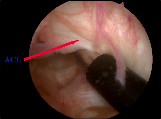https://cdn.ncbi.nlm.nih.gov/pmc/blobs/7526/11662888/b91fbf652a10/gr4.jpg