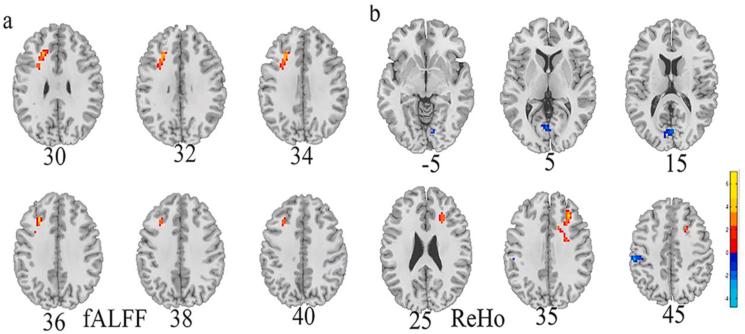 https://cdn.ncbi.nlm.nih.gov/pmc/blobs/7527/9860458/c2ddafe4ec5c/gr1.jpg