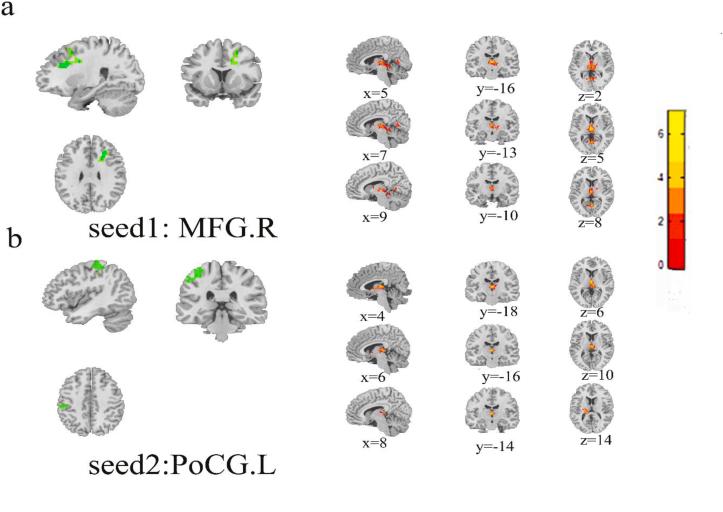 https://cdn.ncbi.nlm.nih.gov/pmc/blobs/7527/9860458/c74e765f0837/gr2.jpg