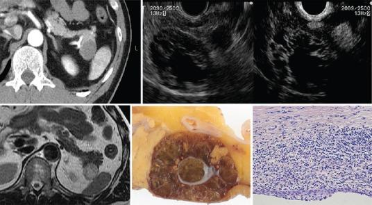 https://cdn.ncbi.nlm.nih.gov/pmc/blobs/752d/4672589/2b00ba31ac62/EUS-4-312-g013.jpg