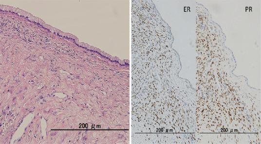https://cdn.ncbi.nlm.nih.gov/pmc/blobs/752d/4672589/b6a272f68ca2/EUS-4-312-g006.jpg