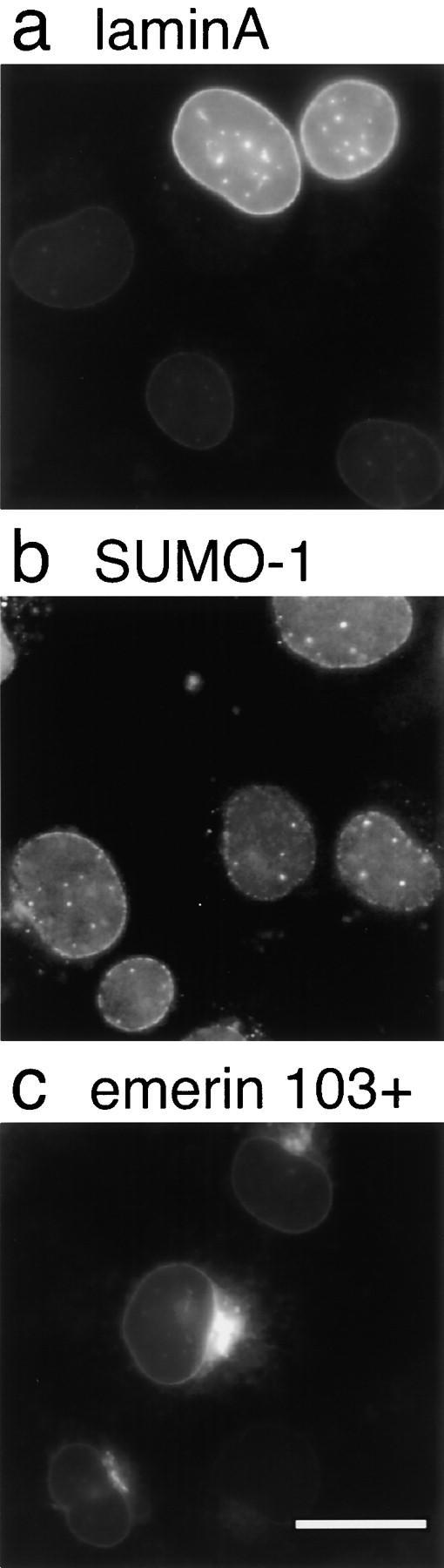 https://cdn.ncbi.nlm.nih.gov/pmc/blobs/7531/2199743/c0fce50eb6e5/JCB9904078.f3.jpg