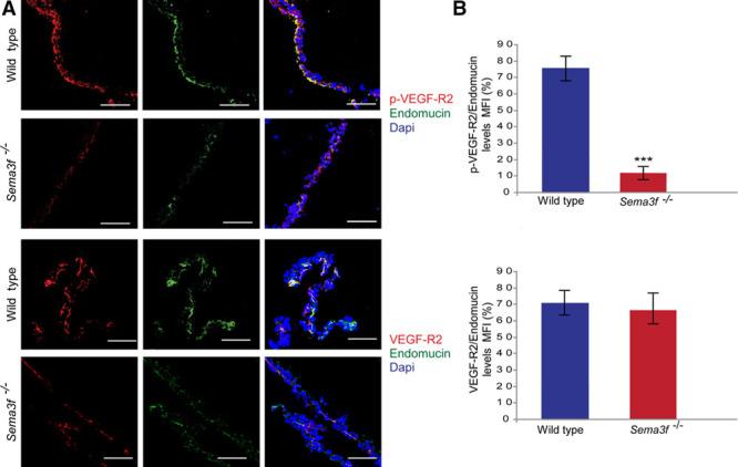 https://cdn.ncbi.nlm.nih.gov/pmc/blobs/7531/5567401/36182cf3e3b0/atv-37-1710-g007.jpg