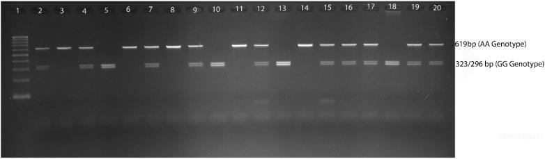 https://cdn.ncbi.nlm.nih.gov/pmc/blobs/7537/10606196/1a924fa17652/diagnostics-13-03214-g001.jpg