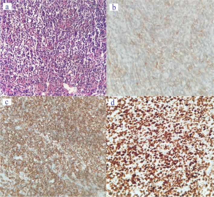 https://cdn.ncbi.nlm.nih.gov/pmc/blobs/7538/9881271/a2fc0b64a821/12885_2023_10548_Fig1_HTML.jpg