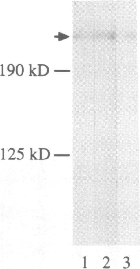 https://cdn.ncbi.nlm.nih.gov/pmc/blobs/753a/398134/ea4493f074d1/emboj00028-0080-a.jpg