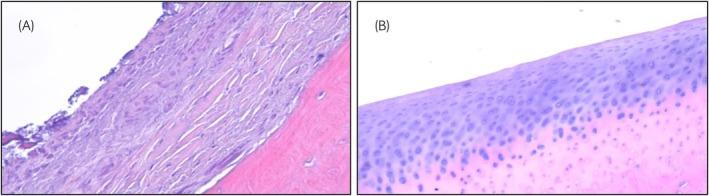 https://cdn.ncbi.nlm.nih.gov/pmc/blobs/753b/12135755/90915b44f4e1/EVJ-57-1138-g002.jpg