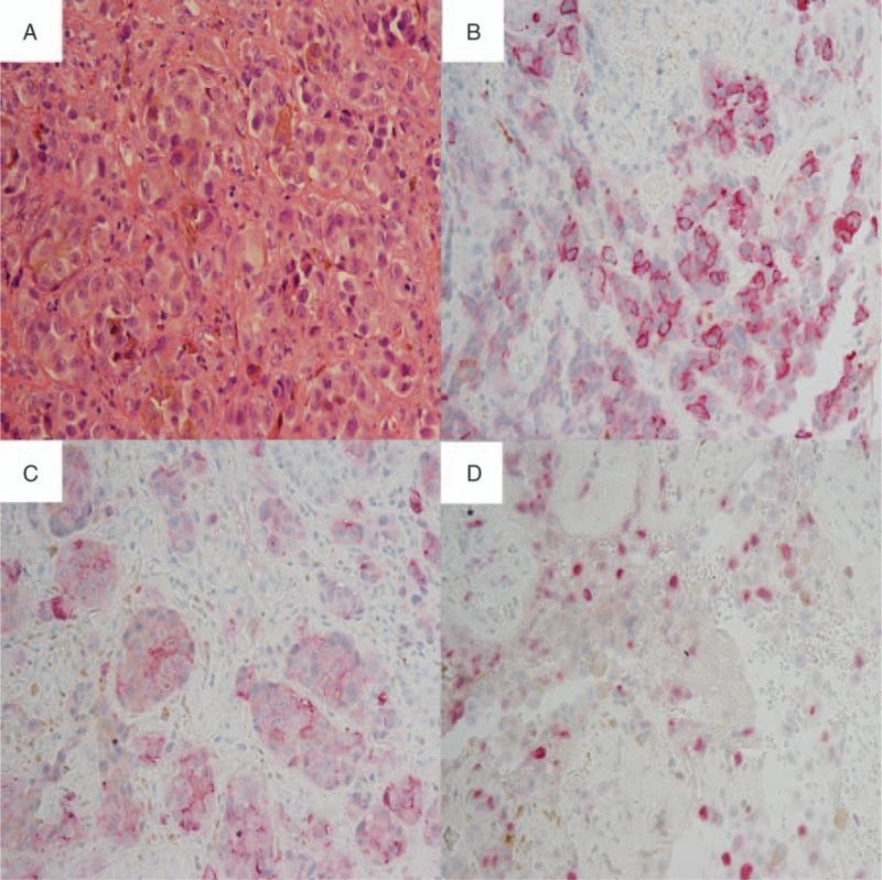 https://cdn.ncbi.nlm.nih.gov/pmc/blobs/753d/5521911/e717c4247e01/medi-96-e7541-g002.jpg