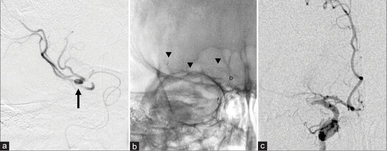 https://cdn.ncbi.nlm.nih.gov/pmc/blobs/7541/7771481/45fbfa5e57e4/SNI-11-446-g002.jpg