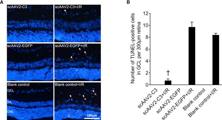 https://cdn.ncbi.nlm.nih.gov/pmc/blobs/7544/7200613/fa23c3beea81/gr3.jpg