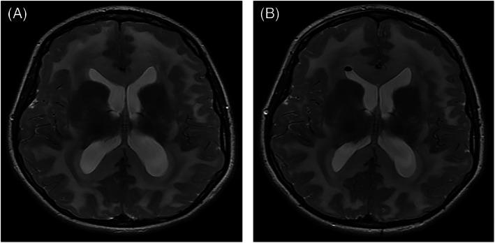 https://cdn.ncbi.nlm.nih.gov/pmc/blobs/7549/9259398/b9b37dc31935/JMD2-63-379-g001.jpg