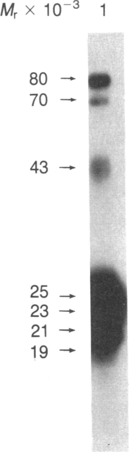 https://cdn.ncbi.nlm.nih.gov/pmc/blobs/755b/391265/568afe9165de/pnas00359-0281-a.jpg