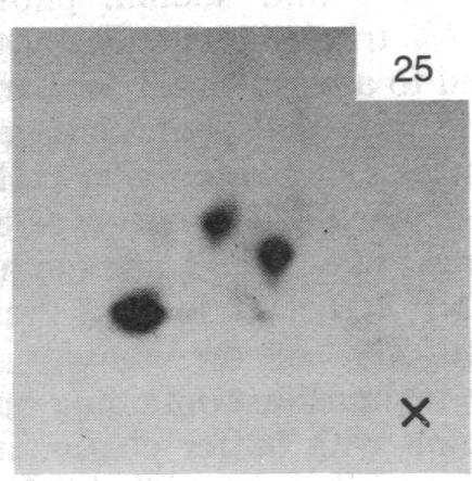 https://cdn.ncbi.nlm.nih.gov/pmc/blobs/755b/391265/57d08712e45a/pnas00359-0282-b.jpg