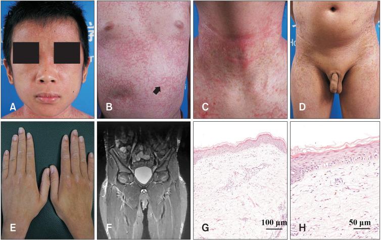 https://cdn.ncbi.nlm.nih.gov/pmc/blobs/7565/10608403/bab38c6525f4/ad-35-S79-g001.jpg