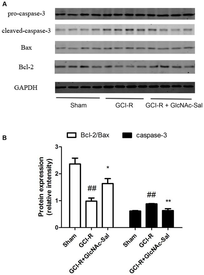 https://cdn.ncbi.nlm.nih.gov/pmc/blobs/7568/4084628/de612337ab04/pone.0100126.g010.jpg