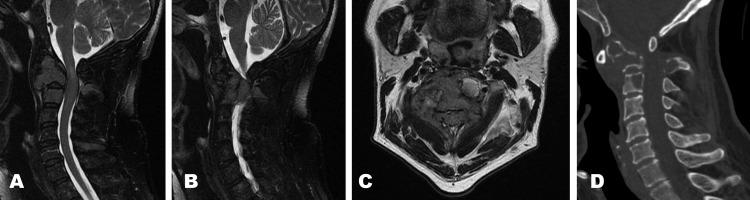 https://cdn.ncbi.nlm.nih.gov/pmc/blobs/756d/10757504/26e2d508b146/cureus-0015-00000049716-i01.jpg