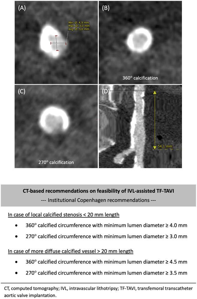 https://cdn.ncbi.nlm.nih.gov/pmc/blobs/7578/8492918/51942f0fc4ae/fcvm-08-739750-g0002.jpg