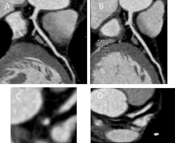 https://cdn.ncbi.nlm.nih.gov/pmc/blobs/758d/7066830/fb48c06e3645/ecr-15-1-g001.jpg