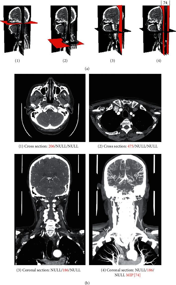 https://cdn.ncbi.nlm.nih.gov/pmc/blobs/758e/7737442/f8d5c66739a9/JHE2020-8838390.003.jpg