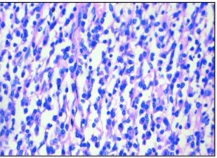 https://cdn.ncbi.nlm.nih.gov/pmc/blobs/7591/11439187/0ecbddb6e974/cureus-0016-00000068184-i07.jpg