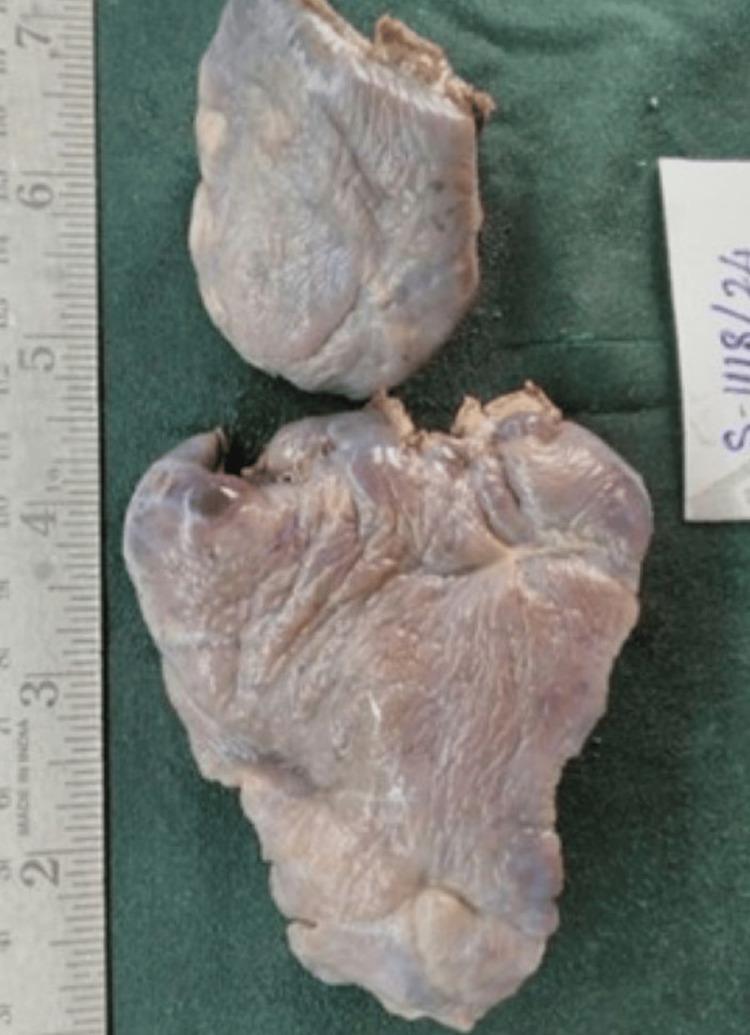https://cdn.ncbi.nlm.nih.gov/pmc/blobs/7591/11439187/a8733c1e7764/cureus-0016-00000068184-i05.jpg