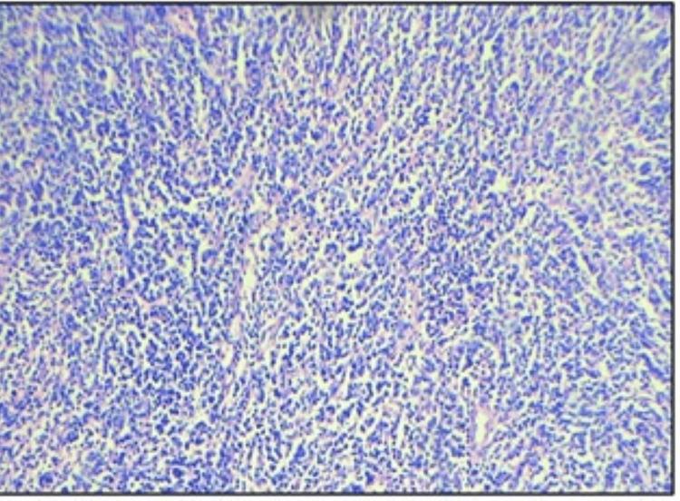 https://cdn.ncbi.nlm.nih.gov/pmc/blobs/7591/11439187/ac5e8f1d278a/cureus-0016-00000068184-i06.jpg