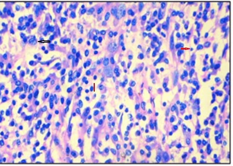 https://cdn.ncbi.nlm.nih.gov/pmc/blobs/7591/11439187/c872744a75ae/cureus-0016-00000068184-i08.jpg