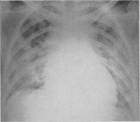 https://cdn.ncbi.nlm.nih.gov/pmc/blobs/7593/1825466/431dbf026b8a/canmedaj00705-0037-a.jpg