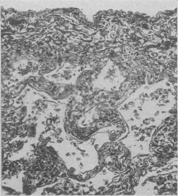 https://cdn.ncbi.nlm.nih.gov/pmc/blobs/7593/1825466/b9b0e18544cc/canmedaj00705-0037-c.jpg
