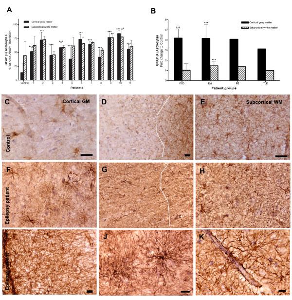 https://cdn.ncbi.nlm.nih.gov/pmc/blobs/7596/2811703/9585548d4b71/1742-2094-6-38-2.jpg