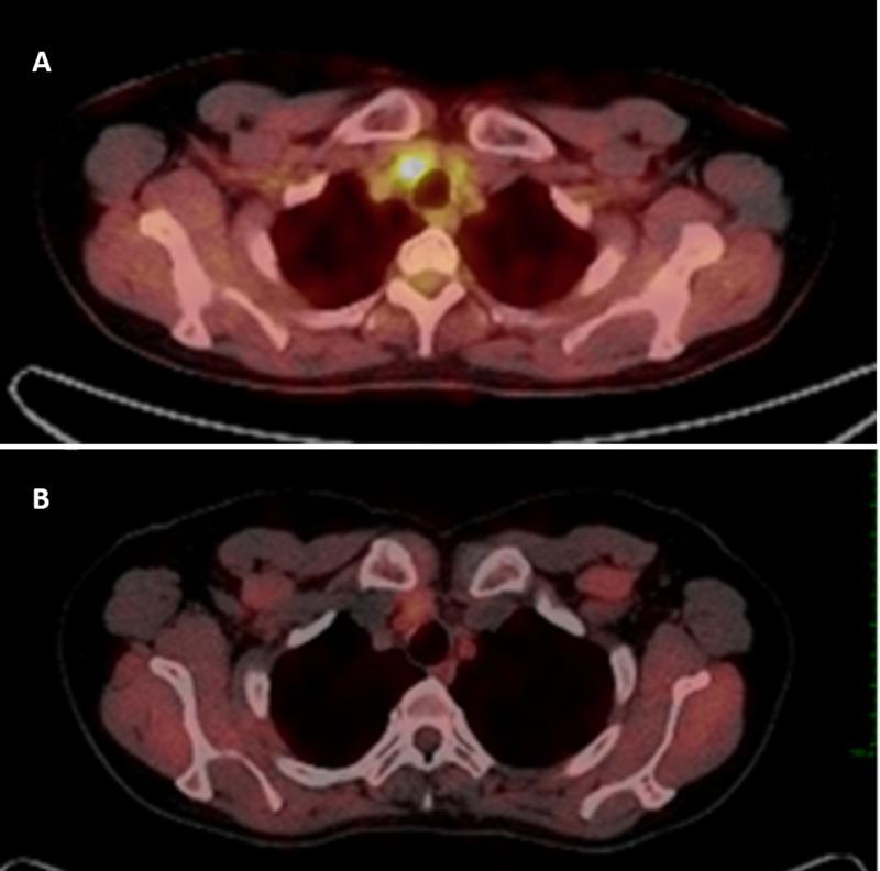 https://cdn.ncbi.nlm.nih.gov/pmc/blobs/759c/7581221/e38fef1b26e9/cureus-0012-00000010596-i01.jpg
