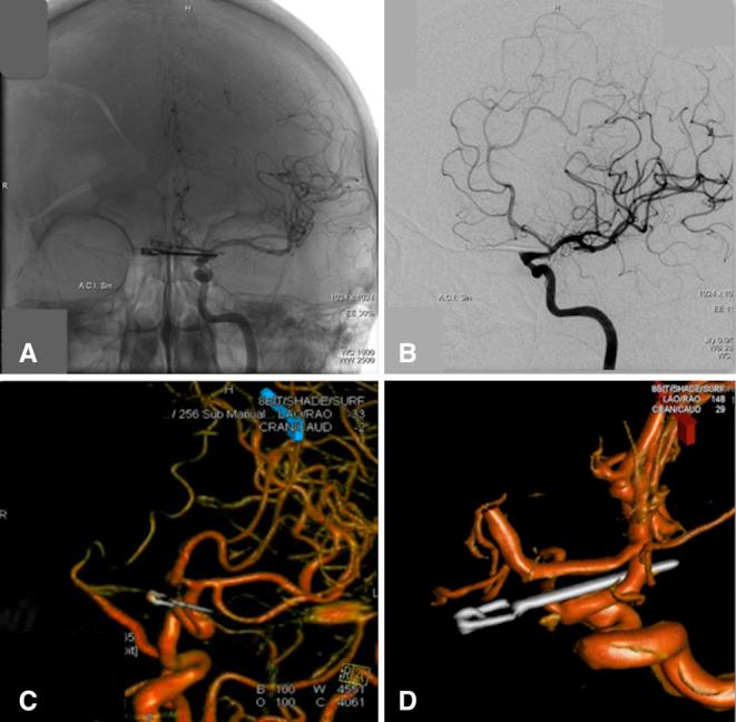 https://cdn.ncbi.nlm.nih.gov/pmc/blobs/75a1/11301584/8d8c36beb960/CASE2473_figure_3.jpg
