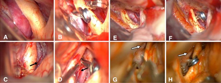 https://cdn.ncbi.nlm.nih.gov/pmc/blobs/75a1/11301584/dd6842c8eaf4/CASE2473_figure_2.jpg