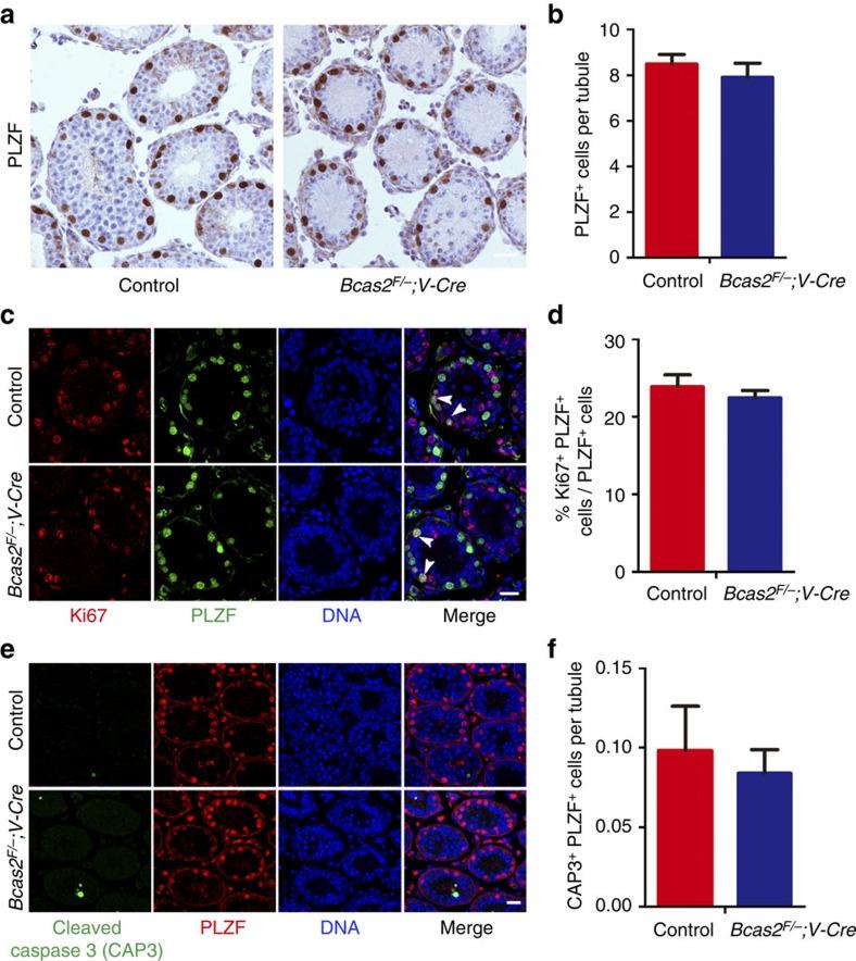 https://cdn.ncbi.nlm.nih.gov/pmc/blobs/75a5/5290162/5748f96df830/ncomms14182-f4.jpg
