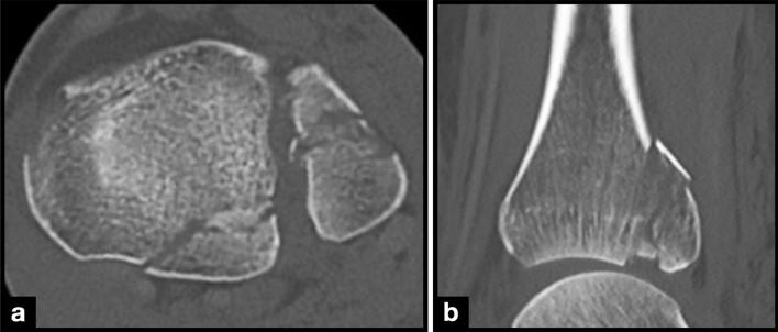 https://cdn.ncbi.nlm.nih.gov/pmc/blobs/75a8/10175417/9a51bf6690ca/68_2022_2119_Fig1_HTML.jpg