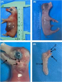 https://cdn.ncbi.nlm.nih.gov/pmc/blobs/75ac/10486337/07b1b5bf0133/AME2-6-294-g006.jpg