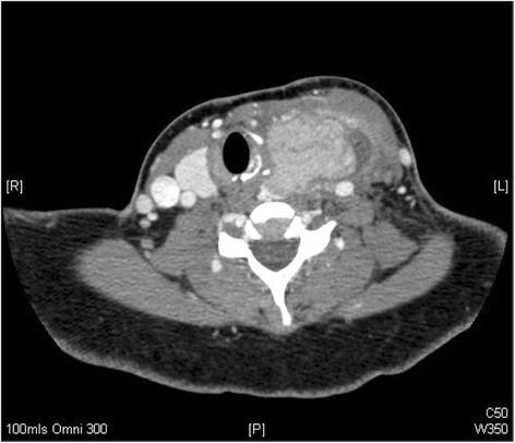 https://cdn.ncbi.nlm.nih.gov/pmc/blobs/75b4/4349691/573128cd3f34/13044_2015_15_Fig2_HTML.jpg