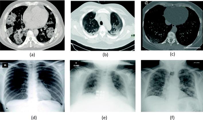 https://cdn.ncbi.nlm.nih.gov/pmc/blobs/75b6/7646727/83f1dc36c3f2/10489_2020_1943_Fig3_HTML.jpg
