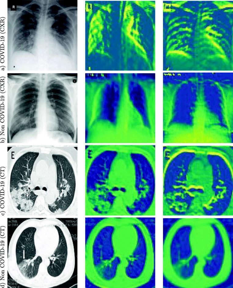 https://cdn.ncbi.nlm.nih.gov/pmc/blobs/75b6/7646727/8be2d7a316fa/10489_2020_1943_Fig2_HTML.jpg
