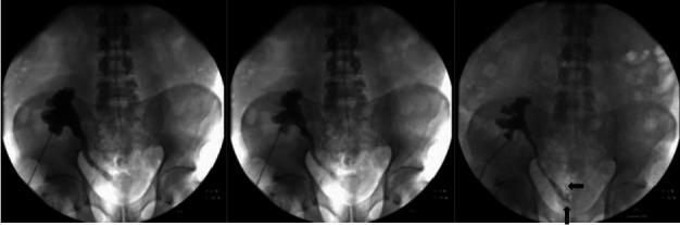 https://cdn.ncbi.nlm.nih.gov/pmc/blobs/75bd/11221224/db269180720c/acc-62_supp2-132-f1.jpg
