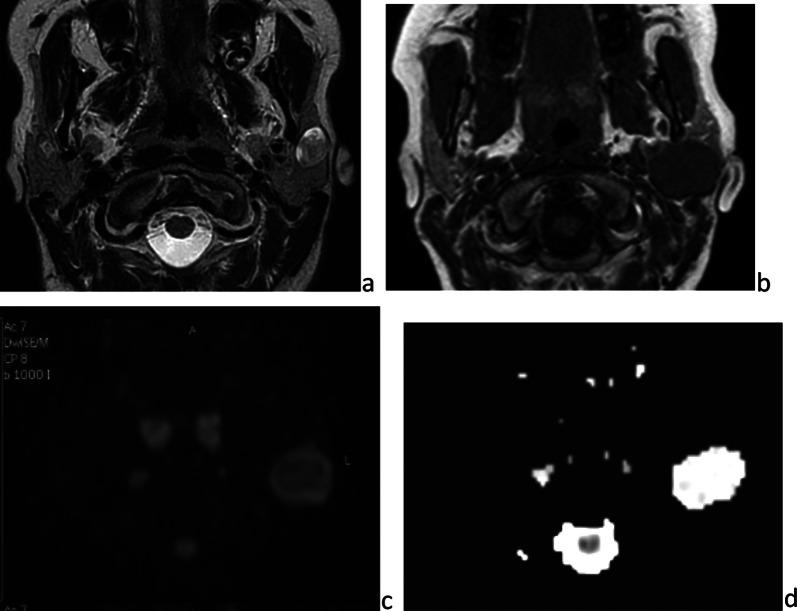 https://cdn.ncbi.nlm.nih.gov/pmc/blobs/75c1/8873326/8986cf7c2d60/13244_2022_1166_Fig14_HTML.jpg