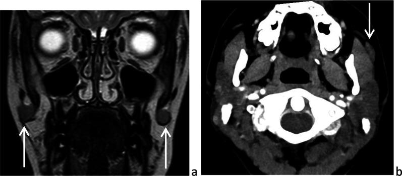 https://cdn.ncbi.nlm.nih.gov/pmc/blobs/75c1/8873326/9ab622b1405c/13244_2022_1166_Fig2_HTML.jpg
