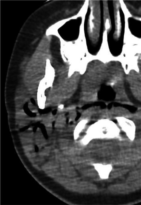 https://cdn.ncbi.nlm.nih.gov/pmc/blobs/75c1/8873326/a626051c6dbc/13244_2022_1166_Fig22_HTML.jpg