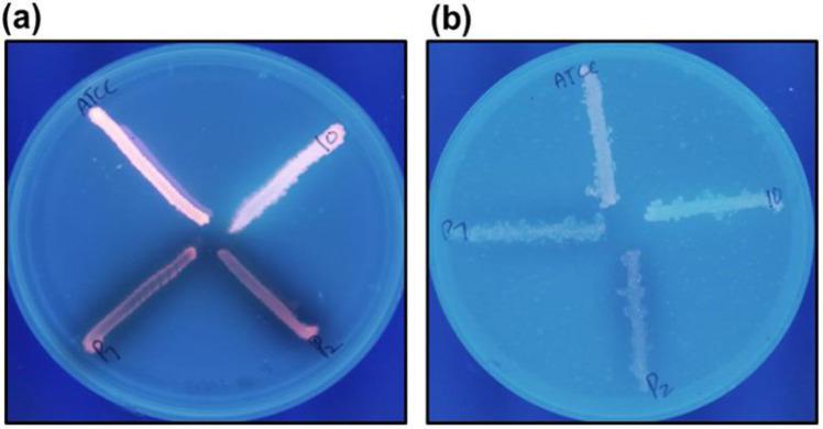 https://cdn.ncbi.nlm.nih.gov/pmc/blobs/75cd/12331453/f4da7a13746e/IJM-17-569-g004.jpg