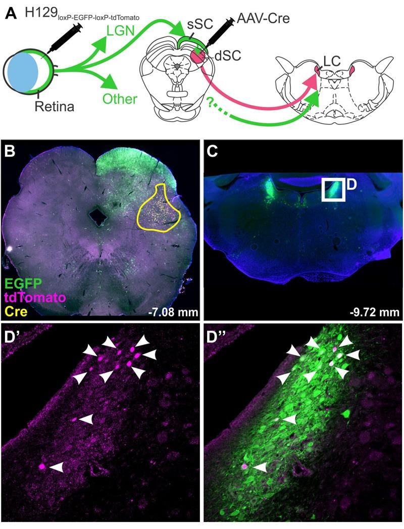 https://cdn.ncbi.nlm.nih.gov/pmc/blobs/75cf/6718611/3398200ce21c/fnins-13-00897-g003.jpg