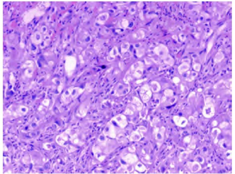 https://cdn.ncbi.nlm.nih.gov/pmc/blobs/75d2/6015156/11640d42ea16/zgfazz-13-6-655-2.jpg