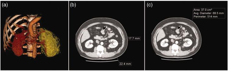 https://cdn.ncbi.nlm.nih.gov/pmc/blobs/75d7/9528033/797bba5ffcd2/10.1177_03000605221125086-fig1.jpg