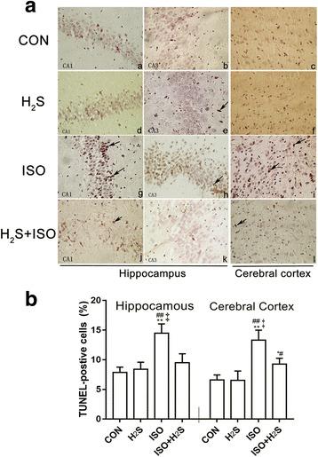 https://cdn.ncbi.nlm.nih.gov/pmc/blobs/75d8/5584335/23b49cb5a013/12871_2017_419_Fig1_HTML.jpg